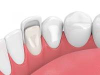 RelyOn Dental image 3